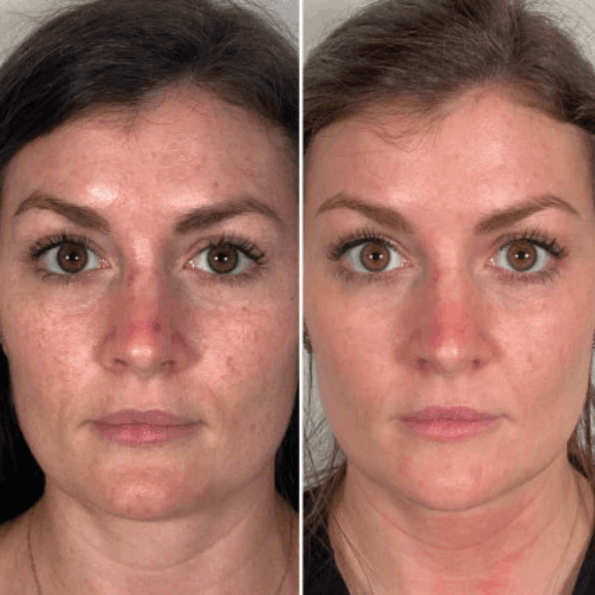 Synevra UltraLift Reviews