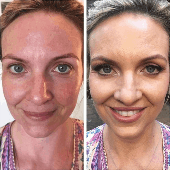 Synevra UltraLift Reviews